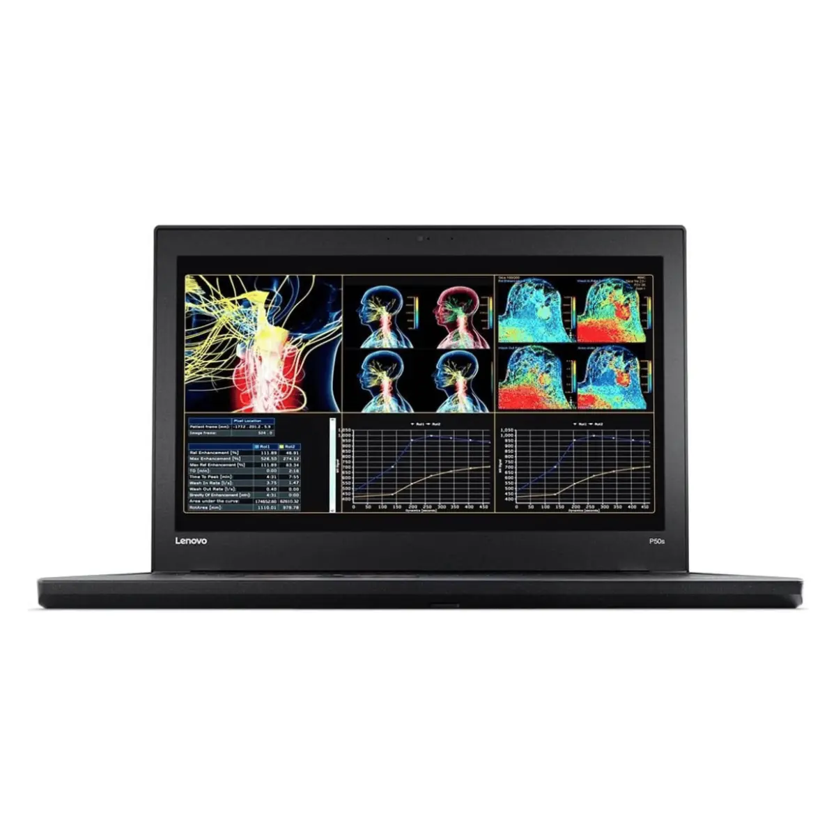 ThinkPad P50s i7-6th, 16GB RAM, 256GB SSD (Pre-Owned)